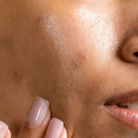 If You Have Oily Skin, Should You Moisturize at Night_