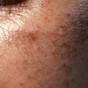 Resveratrol beneficios para la piel_ 5 efectos anti-aging y anti-imperfecciones   - María Monterrubio